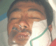 Hazara critically injured in terrorist attack near Wahdat colony in Quetta